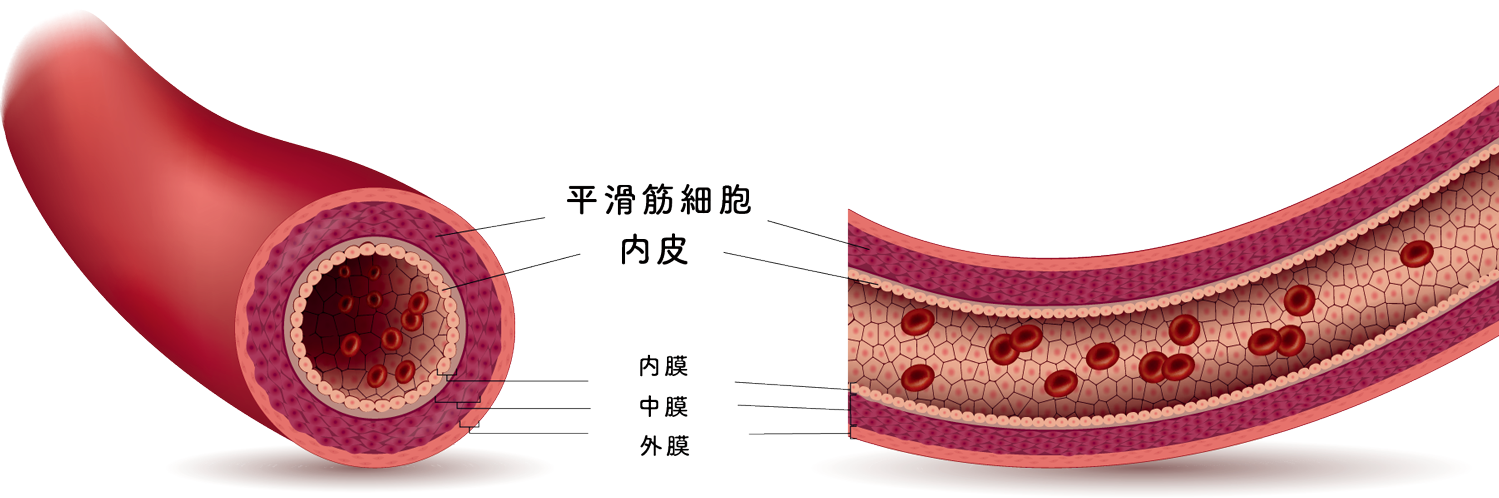 血管断面図
