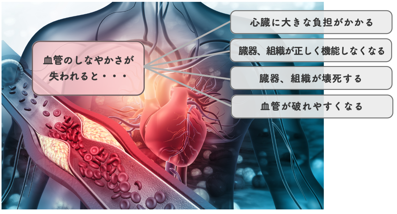 動脈硬化イメージ図